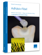 Adhäsiv-Fibel 1004012189 Adhäsiv-Fibel 1004012189