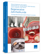 Regenerative Zahnheilkunde (eBook PDF) 1000715125