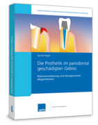 Die Prothetik im parodontal geschädigten Gebiss (eBook) 1000712113