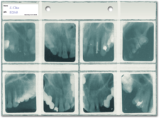 Röntgen-Sammeltasche (für 8 Aufnahmen 4x5 cm) 1007024211 Röntgen-Sammeltasche (für 8 Aufnahmen 4x5 cm) 1007024211