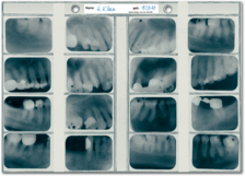 Röntgen-Sammeltasche (für 16 Aufnahmen 3 x 4 cm) 1007024214 Röntgen-Sammeltasche (für 16 Aufnahmen 3 x 4 cm) 1007024214