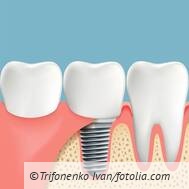 Ist neben der GOZ-Nr. 9040 auch die GOZ-Nr. 4020 berechenbar?