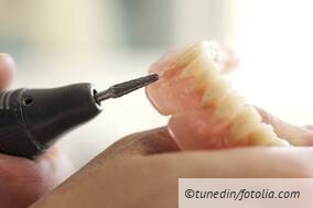 Wie kann eine Remontage berechnet werden?