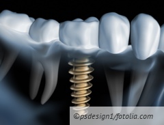 csm Fotolia 27108857 L 4c5168bd43