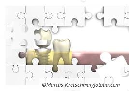 Schrittweise Implantatversorgung: Abrechnung der Bissanhebung mit Kunststoffaufbau bei Langzeitprovisorien