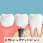csm Fotolia 111301538 S.jpg e38a974bd91a216e80a75a67daf9bc77 d773638d49