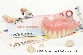 Welche versteckten Kosten haben Sie in Ihrem Dentallabor?