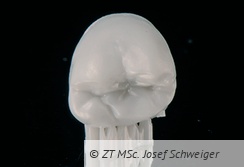 Abb. 12: Lithoz (A-Wien) ermöglicht erstmals den 3D-Druck von Zirkonoxid-Restaurationen. Die extrem detaillierte Wiedergabe der Daten im Kronenrandbereich und den Kauflächen zeichnen diesen Fertigungsweg aus.