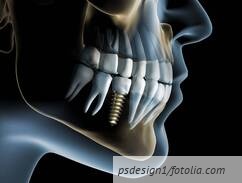 csm Fotolia 27078846 M 1 01.jpg 8c4d303c15fb23535802ceba0a409add ba936a4e79