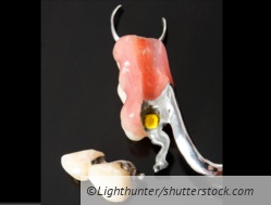 Geschiebe aktivieren richtig berechnen - so geht´s!