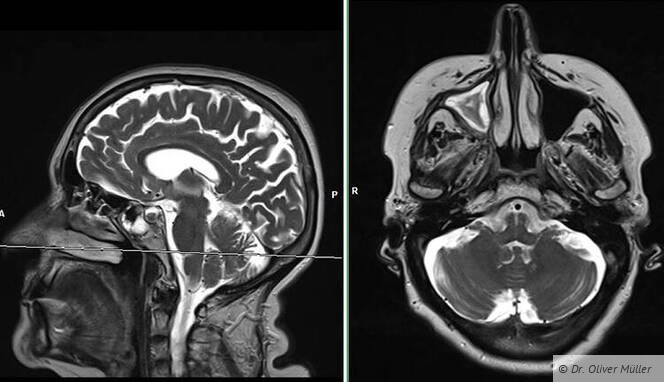 MRT – Zukunft in der Zahnmedizin?