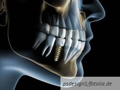 csm Fotolia 27078846 M 1 .jpg 8c4d303c15fb23535802ceba0a409add e9a19f5aad