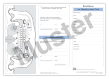 Einwilligung zur Entfernung einer Zyste 1007024412