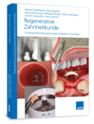 Regenerative Zahnheilkunde (eBook) 1000712125