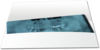 Röntgenkarteitasche Orthopantomograph (OPG) 1007024203