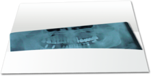 Röntgenkarteitasche Orthopantomograph (OPG) 1007024203