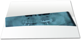 Röntgenkarteitasche Orthopantomograph (OPG) 1007024203